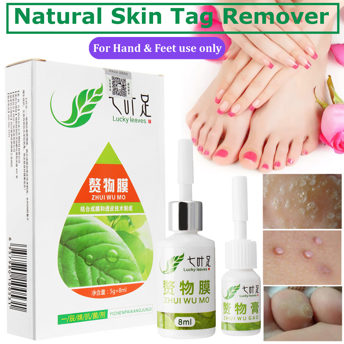 100-Natural-Solution-Foot-Cream-Skin-Tag-Remover-Hand-amp-Feet-Skin-Care-Kit-Set-1360605